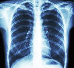 Image of xray.jpg